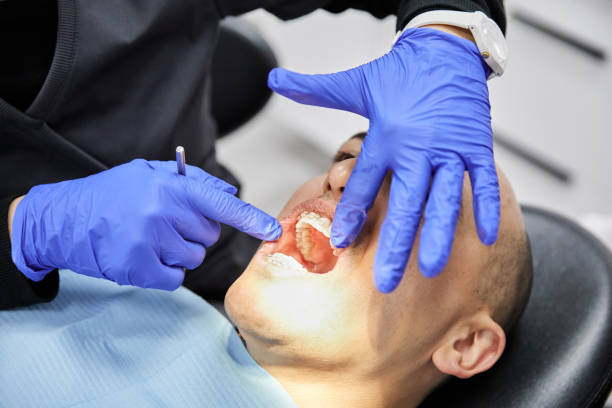 Best Chipped Tooth Repair Near Me  in Ault, CO